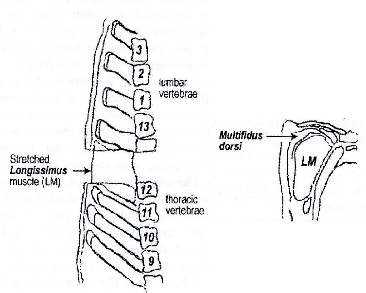 schematic drawing of the tendercut system with a cut in the 12 th 13 th vertebrae region (1)